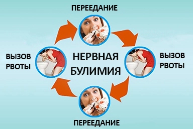 Лечение булимии в Эндирее